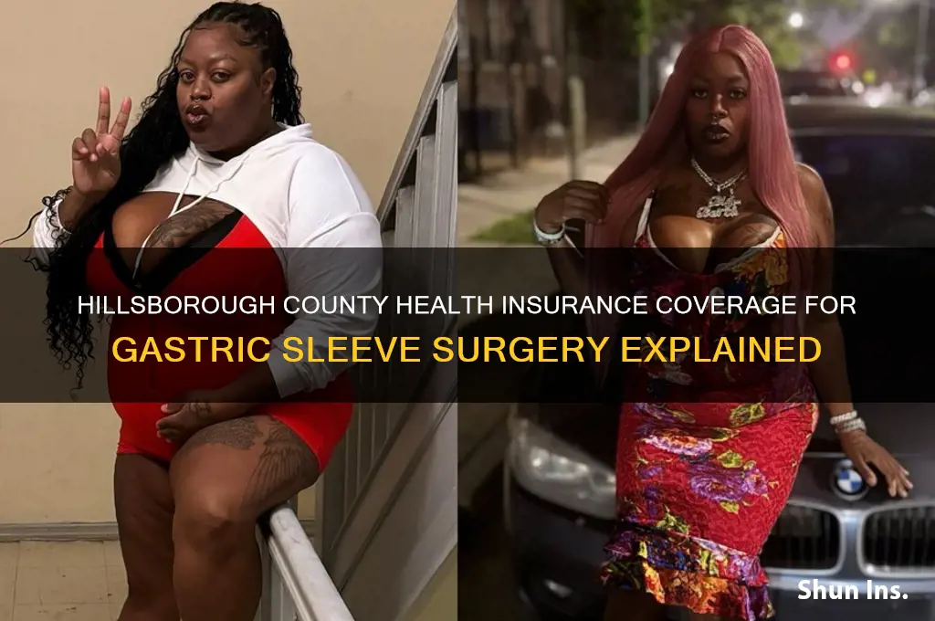 does hillsborough county health insurance gastric sleeve