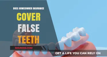 Home Insurance: False Teeth Coverage?