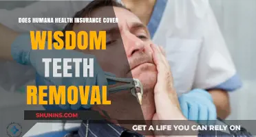 Does Humana Health Insurance Cover Wisdom Teeth Removal?