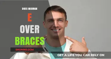 Does Insurance Cover Braces? Understanding Your Orthodontic Coverage Options
