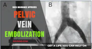 Pelvic Vein Embolization: Insurance Approval and Coverage Explained