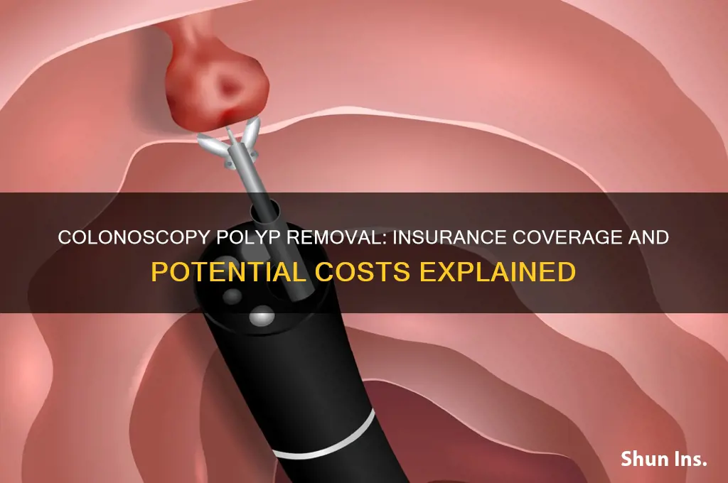 does insurance charge for removal of polyps during a colonoscopy