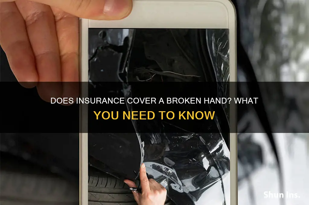 does insurance civer broken hand