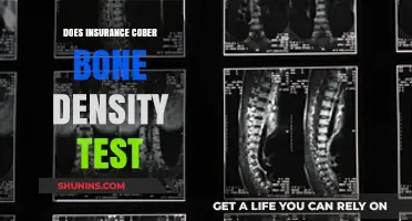 Does Insurance Cover Bone Density Tests? What You Need to Know