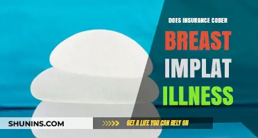 Does Insurance Cover Breast Implant Illness? What You Need to Know