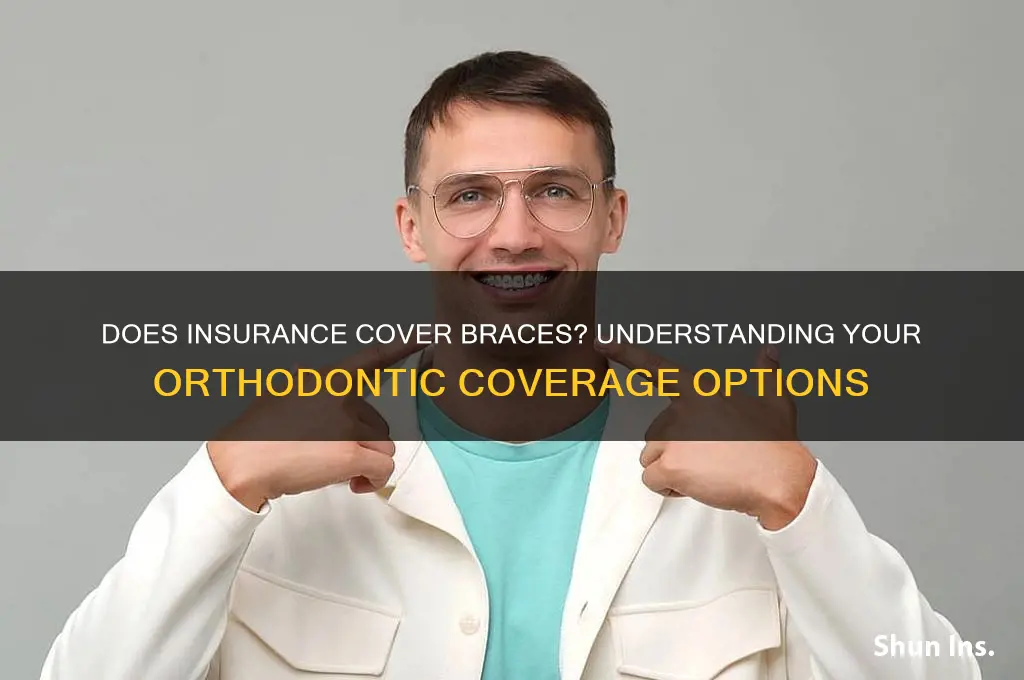does insurance coevr braces