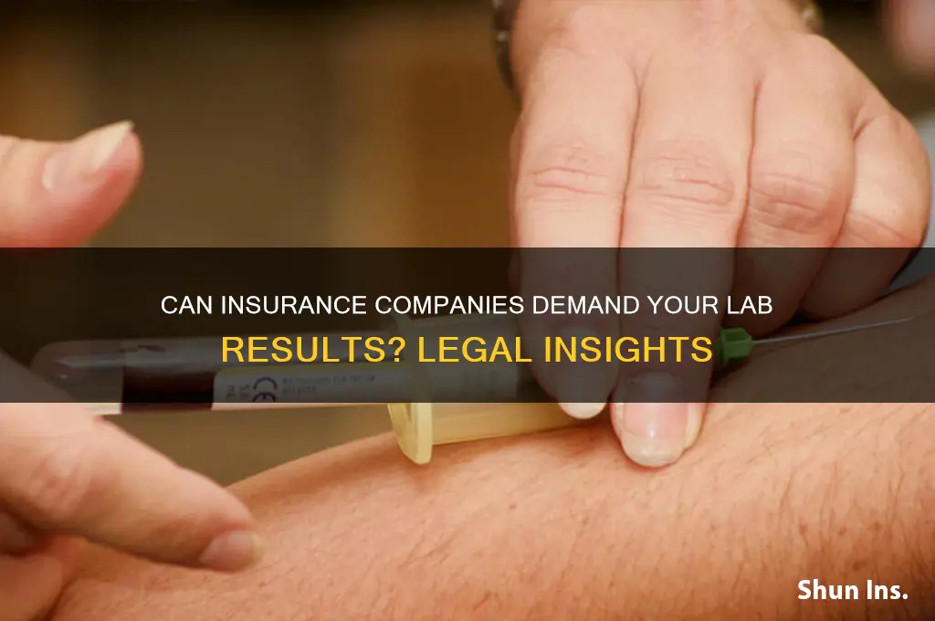 does insurance compay have rightto request lab values