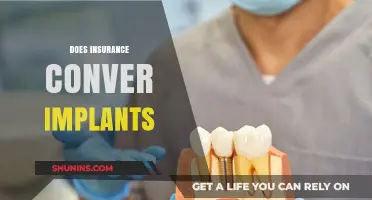 Does Insurance Cover Implants? Understanding Your Policy and Coverage Options