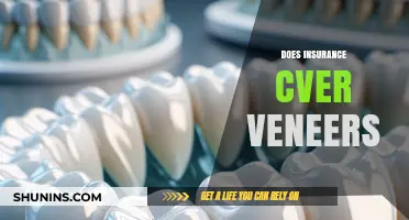 Does Insurance Cover Veneers? Understanding Your Dental Coverage Options