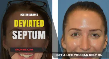 Does Insurance Cover Deviated Septum Surgery? What You Need to Know