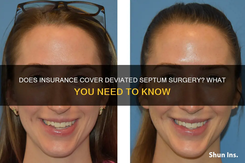 does insurance deviated septum