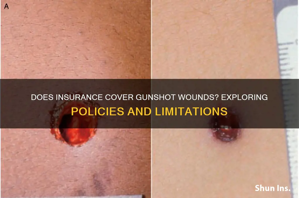 does insurance fix a gunshots