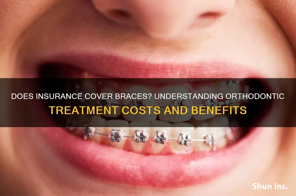 does insurance help with braces