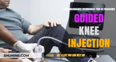 Ultrasound-Guided Knee Injections: Insurance Reimbursement Explained