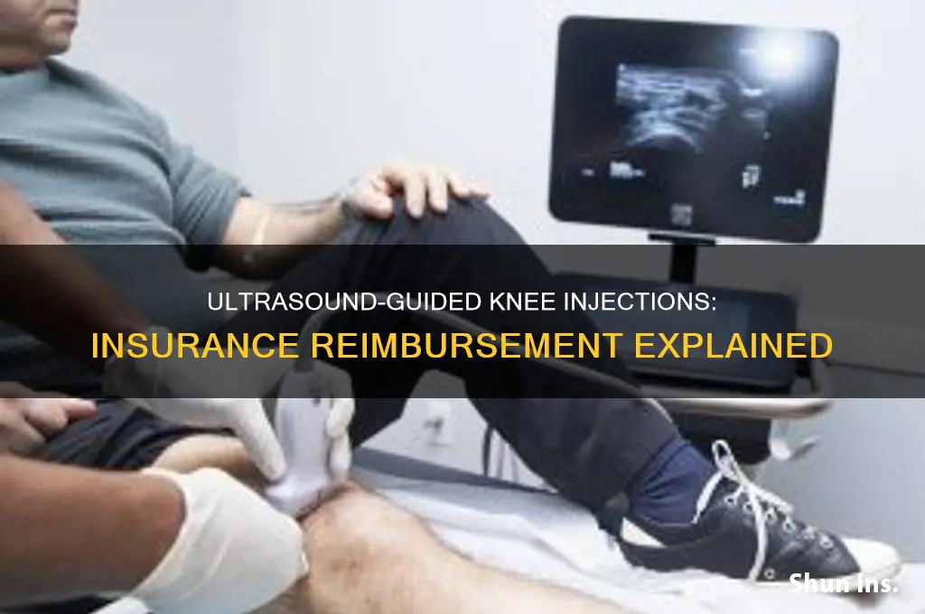 does insurance reimburse for ultrasound guided knee injection