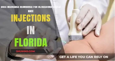Knee Injections: Insurance Reimbursement in Florida