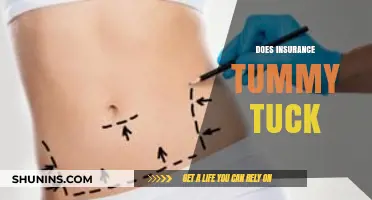 Does Insurance Cover Tummy Tucks? What You Need to Know