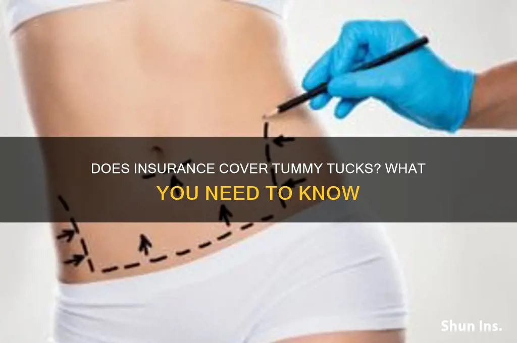 does insurance tummy tuck