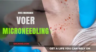 Does Insurance Cover Microneedling? A Comprehensive Guide to Costs and Coverage