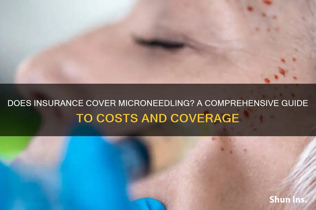 does insurance voer microneedling