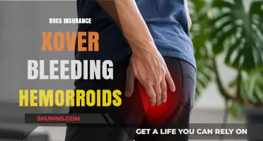 Does Insurance Cover Bleeding Hemorrhoids? A Comprehensive Guide