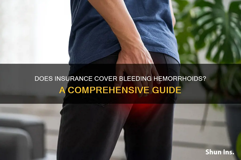 does insurance xover bleeding hemorroids