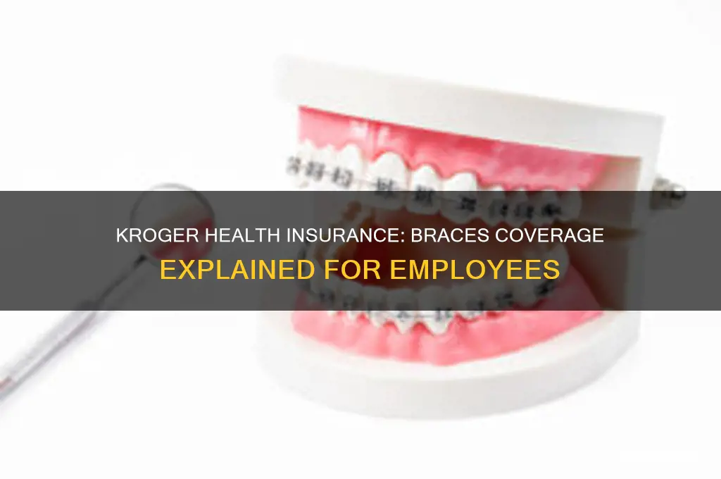 does kroger health insurance cover braces