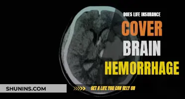 Brain Hemorrhage: Is Life Insurance Coverage Guaranteed?