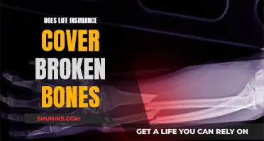 Life Insurance: Broken Bones and Your Coverage