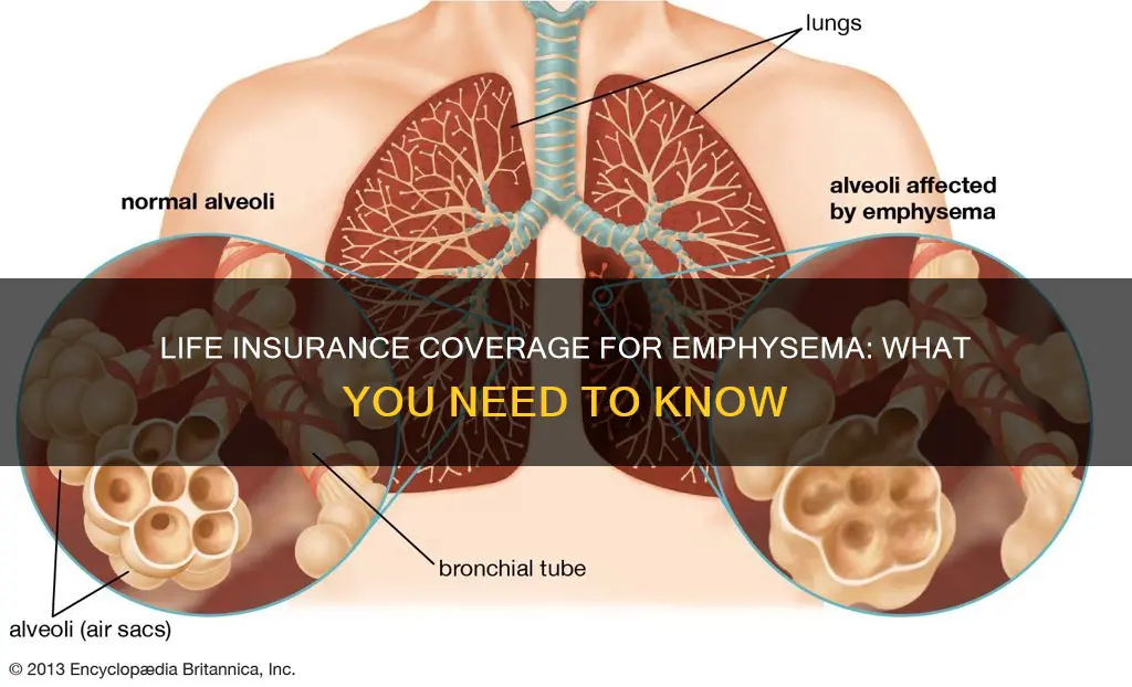 does life insurance cover emphysema