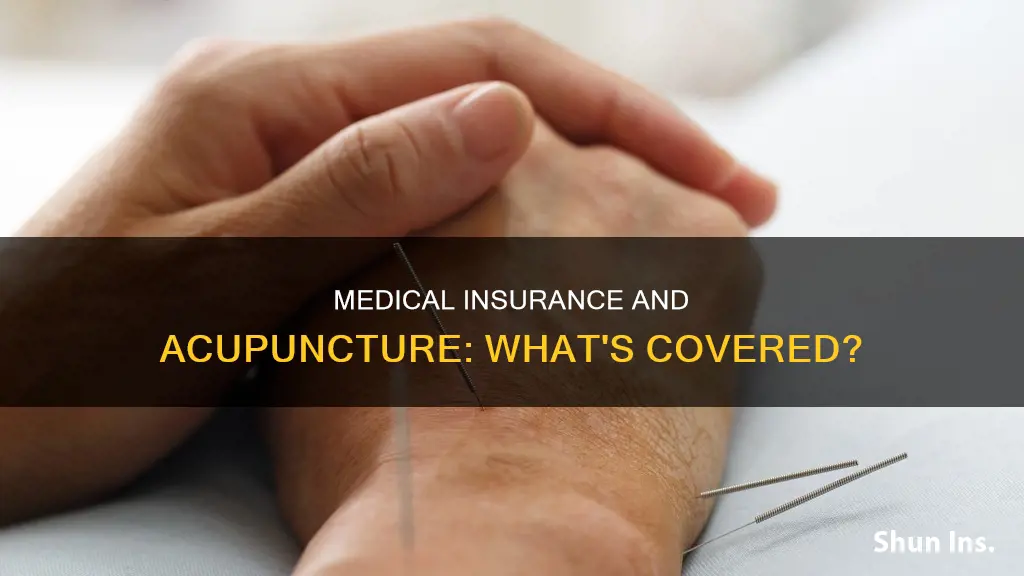 does medical insurance cover acupuncture