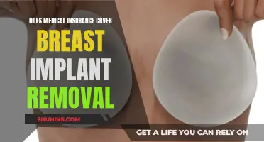 Breast Implant Removal: Is It Covered by Medical Insurance?