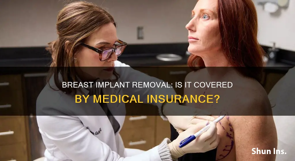 does medical insurance cover breast implant removal