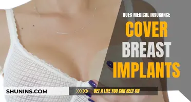 Breast Implants: Unraveling Medical Insurance Coverage and Costs