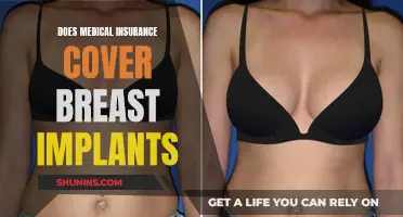 Breast Implants: Are They Covered by Medical Insurance?