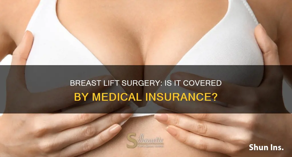 does medical insurance cover breast lift