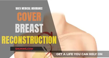 Breast Reconstruction: Is Medical Insurance Coverage Guaranteed?