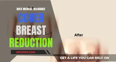 Breast Reduction Surgery: Uncovering Insurance Coverage and Costs