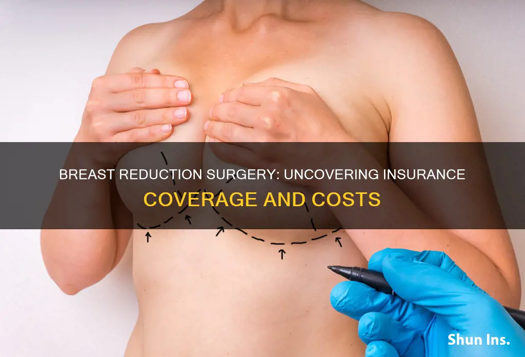 does medical insurance cover breast reduction