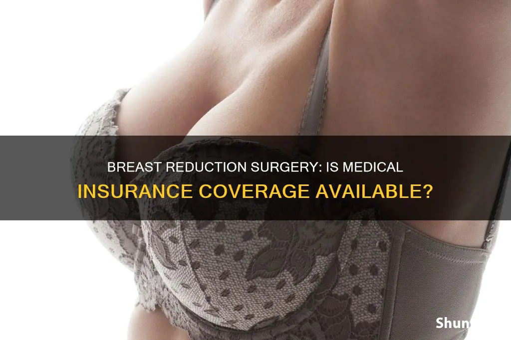 does medical insurance cover breast reduction