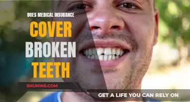 Dental Emergencies: Insurance Coverage for Broken Teeth
