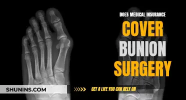 Medical Insurance and Bunion Surgery: What's Covered?