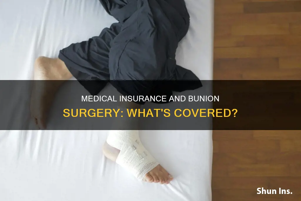 does medical insurance cover bunion surgery