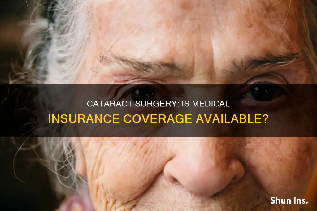 does medical insurance cover cataract surgery