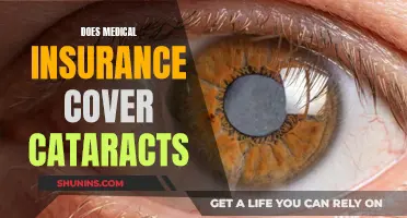 Cataract Surgery: Insurance Coverage and What You Need to Know