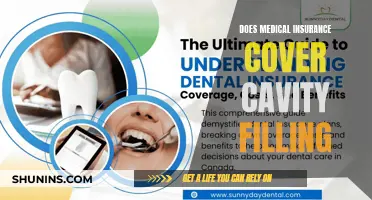 Cavity Filling: Is It Covered by Medical Insurance?