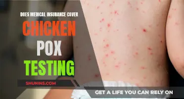 Medical Insurance Coverage for Chicken Pox Testing Explained