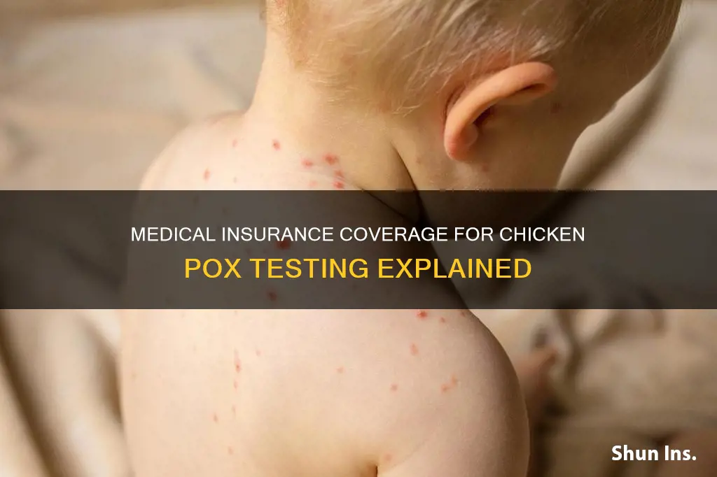 does medical insurance cover chicken pox testing