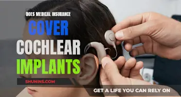 Cochlear Implants: Are They Covered by Medical Insurance?