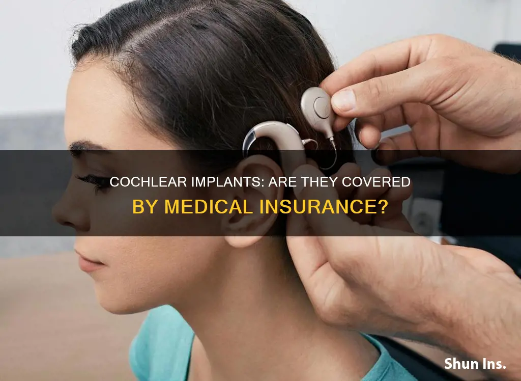 does medical insurance cover cochlear implants